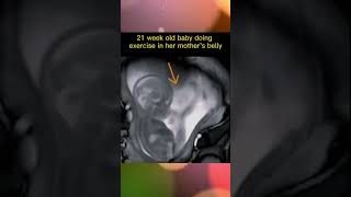 Fetal Movements In WOM MRI scan at 21 week [upl. by Holder199]