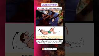 Meningitis मस्तिष्ककीबिमारी meningitis hospital mbbs neetpg neet intership ytvideo ytshorts [upl. by Remark456]