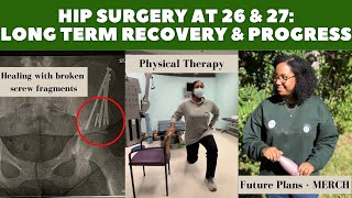 Hip Arthroscopy Labral Repair amp PAO Two Years PostOp amp One Year PostOp from Revision Surgery [upl. by Teik]