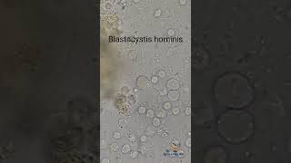 Blastocystis hominis in Stool [upl. by Stambaugh]