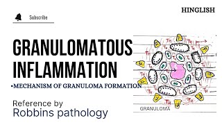 Granulomatous Inflammation  Granuloma formation  Mechanism of Granuloma formation  KTC MBBS [upl. by Chenee]