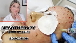 Mesotherapy for face full demo and point by point injection technique [upl. by Esele]