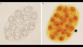 DipylidiumCaninum Infektion mit Gurkenkernbandwurm [upl. by Mortie3]