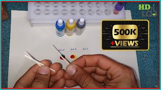 Blood Group Test Experiment Harib Diagnostic Lab [upl. by Arenahs]