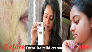 xtralite mild cream Dark spot remover cream  Dailyvlogerpriyanka [upl. by Ruel]