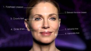 TimeWise Repair® VoluFill™ Deep Wrinkle Filler [upl. by Atinreb]