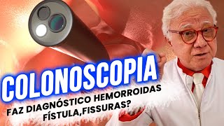 Colonoscopia Faz diagnóstico Hemorroidas fissuras fístulas [upl. by Sungam]