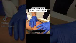 Reduction of a Patellar Dislocation [upl. by Annelg460]