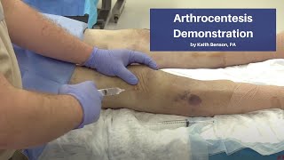 Arthrocentesis Demonstration  The CadaverBased EM Procedures SelfStudy Course [upl. by Sylado684]