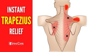 How to Relieve Trapezius Pain FOR GOOD [upl. by Leirum]