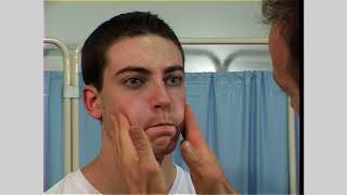 Facial nerve examination  Seventh cranial nerve [upl. by Lleruj]