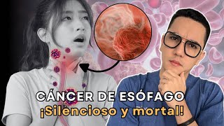 Cáncer de esófago silencioso y mortal  Dr William Guerrero [upl. by Shirley]