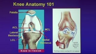 Common Traumatic Knee Injuries Oh My Aching Knee [upl. by Rochkind]