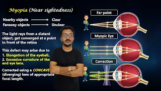 Eye Defects l Myopia amp Hypermetropia l Presbyopia l Causes l Correction l by Jay Sir l class10 [upl. by Nydia]