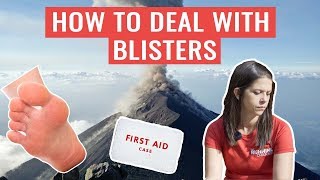 Should You Pop A Blister  HOW TO Deal With Blisters [upl. by Baily]