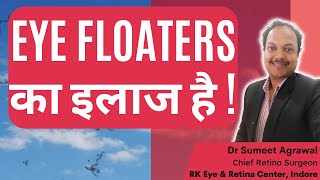 EYE FLOATERS का इलाज है  DO NOT LOSE HOPE  EYE FLOATERS को हटाया जा सकता है [upl. by Beckett]