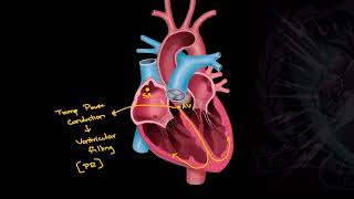 Should we use Adenosine in WPW with AFib  Critical ECGs  Good Reads  42024 [upl. by Baptlsta]