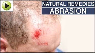 Skin Care  Abrasion  Natural Ayurvedic Home Remedies [upl. by Gibrian878]