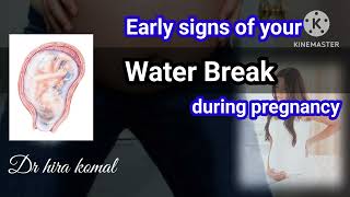 early signs of water break during pregnancy drhirakomal [upl. by Rutan255]