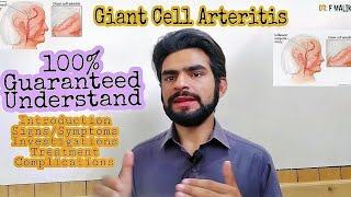 Giant Cell Arteritis in urdu hindi  Temporal Arteritis [upl. by Mohkos]