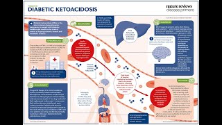 CETOACIDOSIS DIABÉTICA [upl. by Ayor]