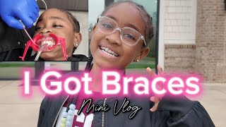 I got braces at 8 years old to fix my crossbite  Orthodontic Treatment [upl. by Ramedlab]