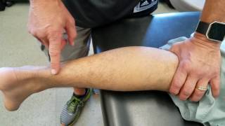 Thompsons test for Achilles tendon rupture [upl. by Prochora622]