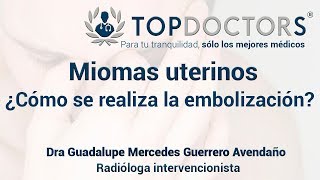 Miomas uterinos Embolización de miomas ¿Cómo se realiza [upl. by Harli]