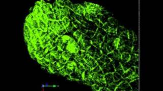 Microtubule dynamics in an Arabidopsis leaf [upl. by Akimit]