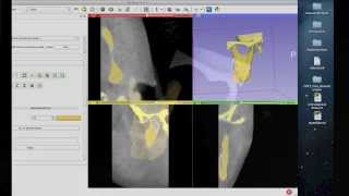 Tutorial Preparing Data for 3D Printing Using 3D Slicer [upl. by Kulda]