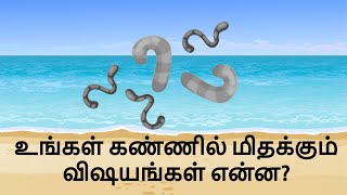 Eye Floaters  Flashes Causes and Cure in Tamil மிதவைகள் [upl. by Aenert]