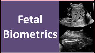 Normal Fetal biometrics [upl. by Aicinad]