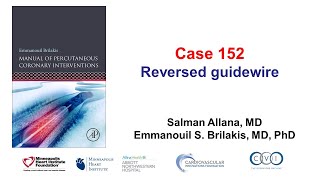 Case 152 PCI Manual  Reversed guidewire [upl. by Inalawi]