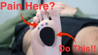 Metatarsal Pad Correct Placement [upl. by Mariandi]