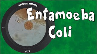 Entamoeba coli  como reconhecer e diferenciar de Entamoeba histolytica [upl. by Annairt987]