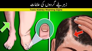 7 warning Signs that your kidneys are Toxic  Khraab Gurday ki ilamaat  Dn Ali [upl. by Thgiwed403]