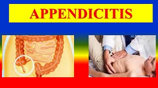 APPENDICITIS  definition causes pathophysiology  clinical features  diagnosis  management [upl. by Fogg]