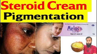 Steroid cream Side effect on face  Pigmentation कैसे ठीक करें ॰॰ Dr Prateek chauhan [upl. by Jennica625]