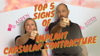 TOP 5 SIGNS OF IMPLANT CAPSULAR CONTRACTURE [upl. by Pegeen94]