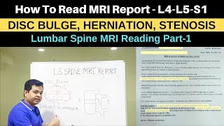 How to read MRI Report Lumbar Spine MRIL4L5S1 MRI for low back pain SciaticaHerniated Disc MRI [upl. by Arevle]