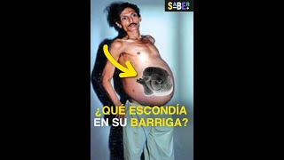 Ocultó un secreto en su barriga por 36 años 🤫 curiosidades [upl. by Francine]