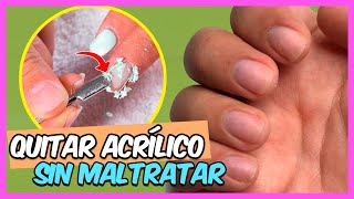 ¿Cómo RETIRAR UÑAS ACRÍLICAS 💚 FÁCIL y SIN LASTIMAR [upl. by Ennavoj]