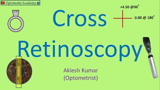 Cross Retinoscopy  Retinoscopy Procedure [upl. by Ahseet]