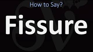 How to Pronounce Fissure CORRECTLY [upl. by Dine986]