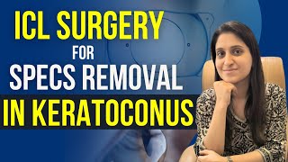 ICL Surgery For Keratoconus [upl. by Ilwain480]