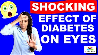 Shocking Effect Of Diabetes On Eye Cataract  Sorbitol Pathway In Diabetes  Daily MED [upl. by Marji]