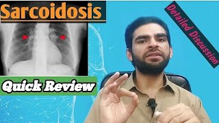 sarcoidosis in urdu hindi  signs amp symptoms investigations treatment [upl. by Llednek]