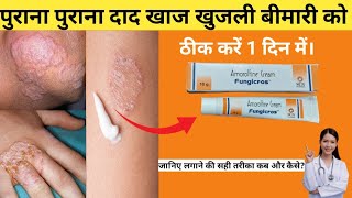 fungicros cream uses in hindi  amorolfline cream fungicros लगाने का सही तरीका जानिए। [upl. by Anitnahs]