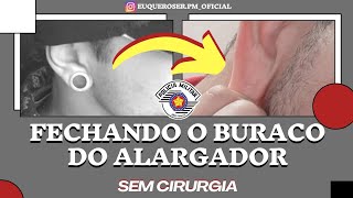 COMO FECHAR O BURACO DO ALARGADOR SEM TER QUE OPERAR EXAME MÉDICO PMSP [upl. by Aihcrop]