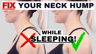 BEST sleeping position to FIX Neck Hump Hunchback or Forward Head Posture  Dr Jon Saunders [upl. by Clovis929]